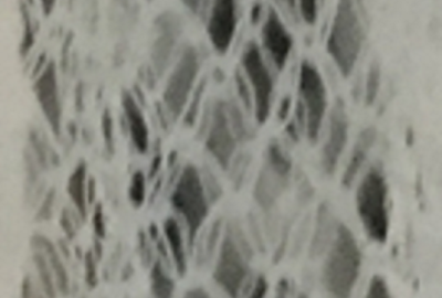 Close up picture of bed net fibers