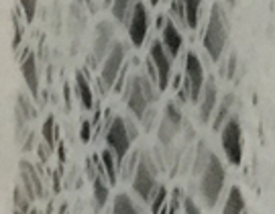 Close up picture of bed net fibers