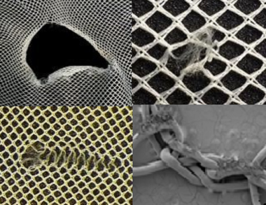 A compilation of four black and white images arranged in a square. Each image shows a different type of damage to the fibers of a bed net.